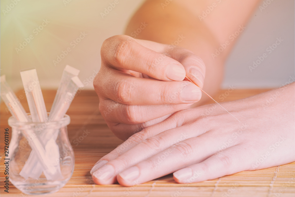 Naklejka premium Hand applying acupuncture needle