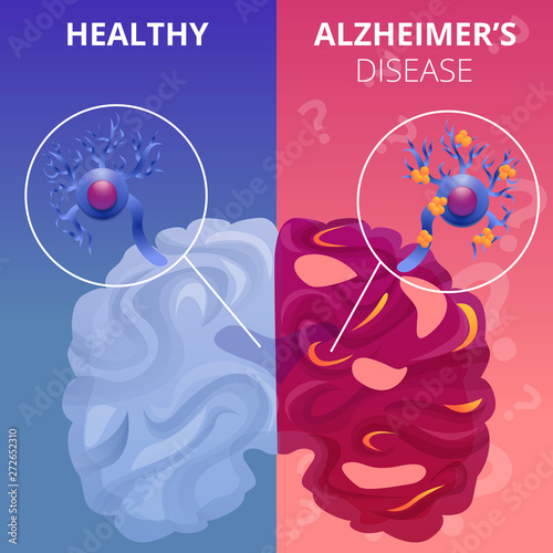 Alzheimer brain banner set. Cartoon illustration of alzheimer brain vector banner set for web design