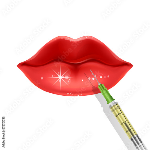 Lips injection, Lip Augmentation. injectable cosmetic filler. Vector illustration in cartoon style for biology, scientific, and medical use.