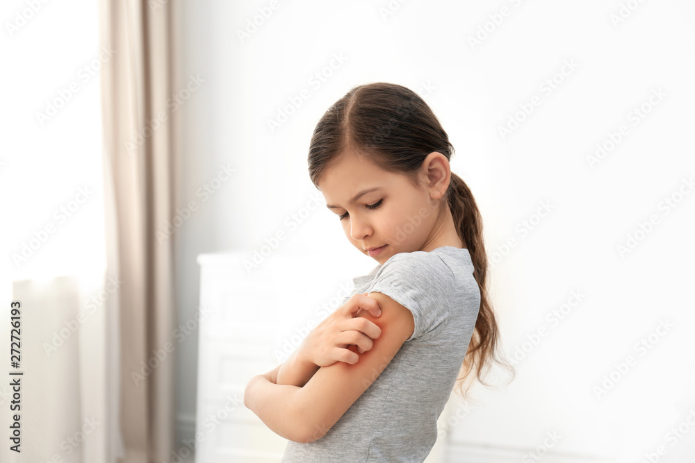 Little girl scratching arm indoors. Allergy symptoms Little girl scratching arm indoors. Allergy symptoms