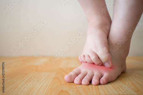 Young woman scratching the itch on her feet w/ redness rash. Cause of itchy skin include athlete's foot (fungal infection), dermatitis (eczema), psoriasis, or bug bites. Health care. Copy space.