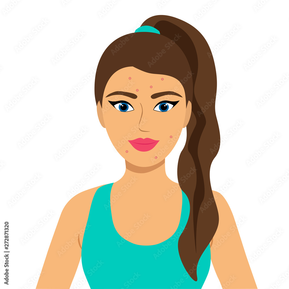 Skin problems. Facial treatment. Flat design. Vector illustration Skin problems. Facial treatment. Flat design. Vector illustration