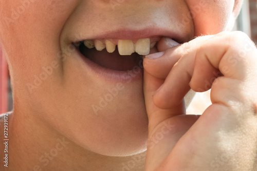 Child shows teeth