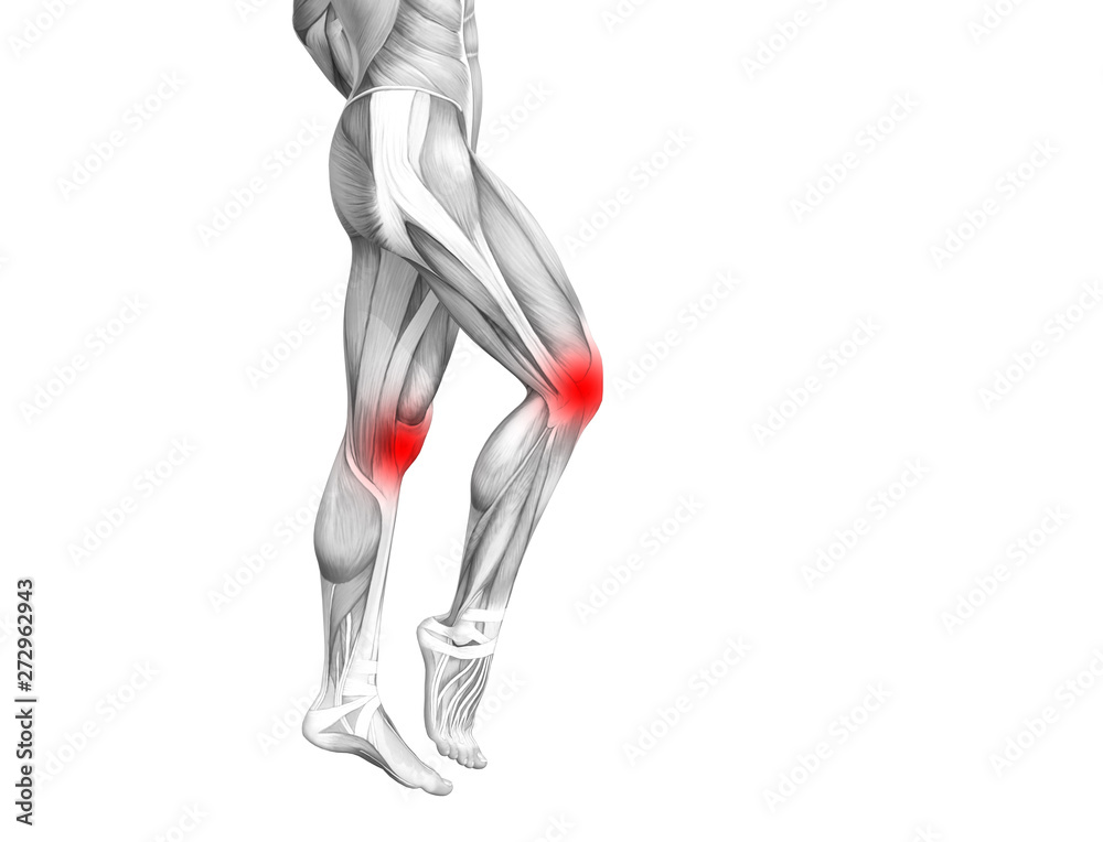 Conceptual knee human anatomy with red hot spot inflammation or articular joint pain for leg health care therapy or sport muscle concepts. 3D illustration man arthritis or bone osteoporosis disease Conceptual knee human anatomy with red hot spot inflammation or articular joint pain for leg health care therapy or sport muscle concepts. 3D illustration man arthritis or bone osteoporosis disease