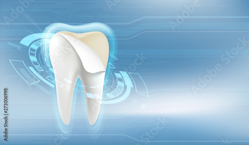 Dental veneers. Tooth whitening and beauty treatment.