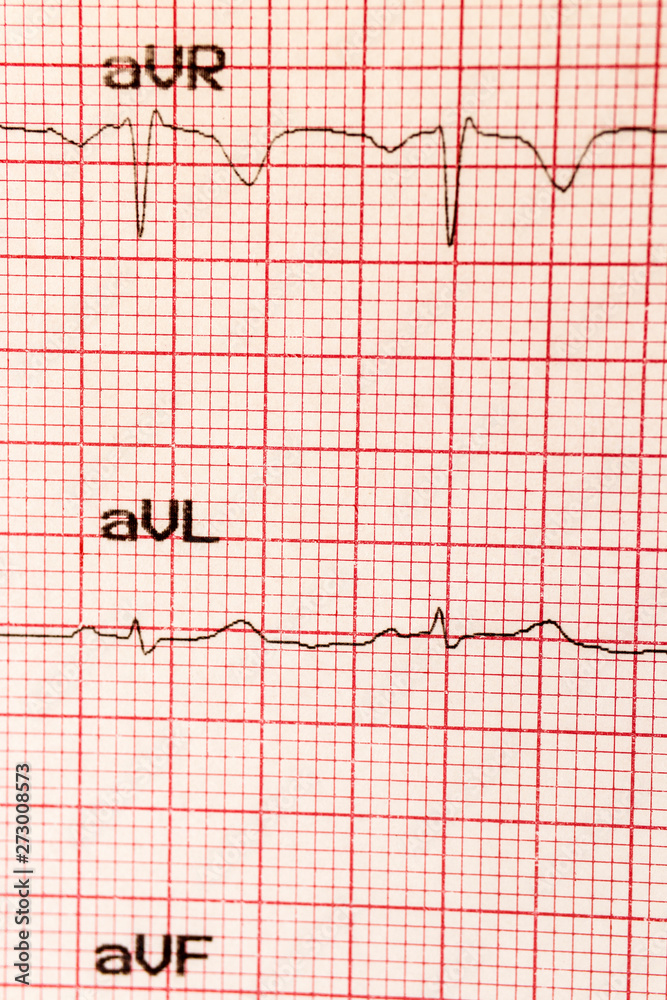 Cardiogram Cardiogram