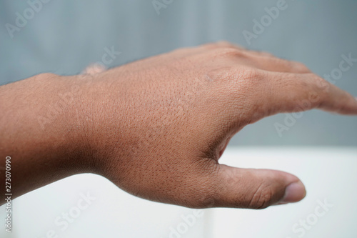 Men's hands, male skin, dry and rough, need skin care © Stock.Foto.Touch