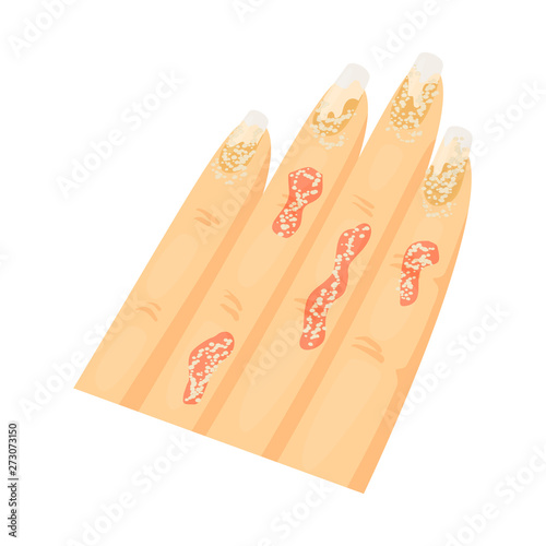 Isolated object of psoriasis  and body logo. Set of psoriasis  and eczema  vector icon for stock.