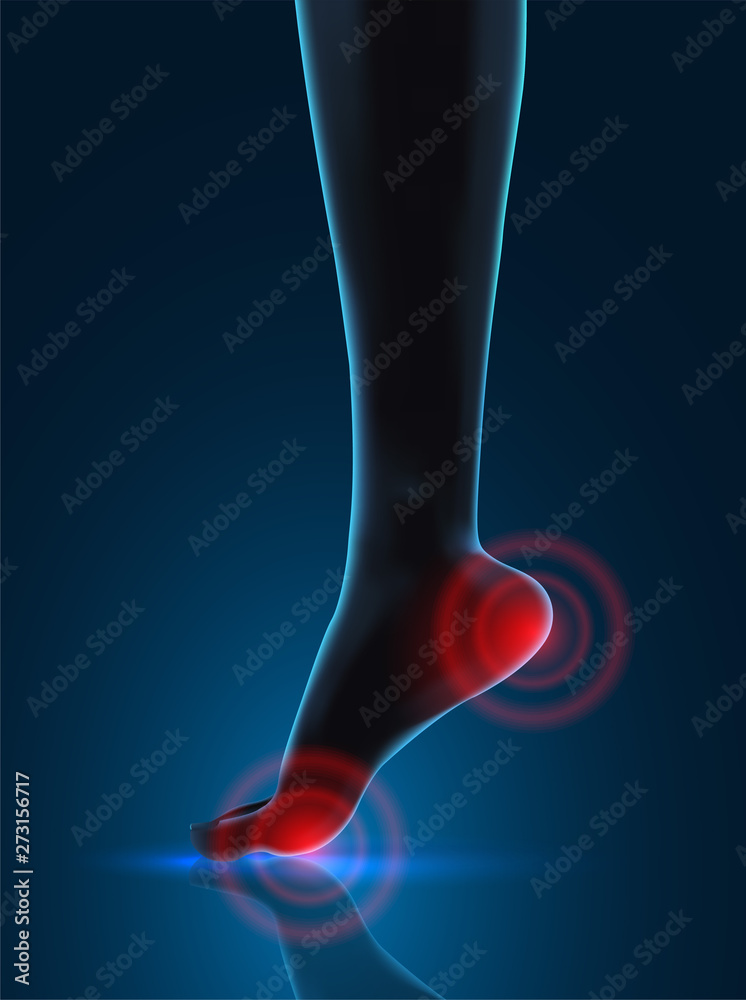 vector human foot. blue contour and red spots of pain. ready element for medicine and orthopedics vector human foot. blue contour and red spots of pain. ready element for medicine and orthopedics