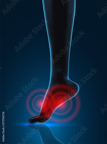 vector human foot. blue contour and red spots of pain. ready element for medicine and orthopedics