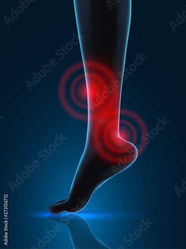 vector human foot. blue contour and red spots of pain. ready element for medicine and orthopedics