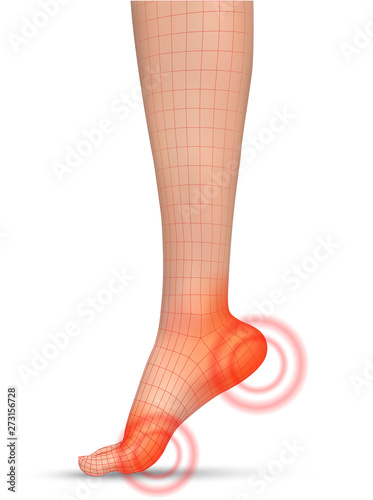 vector human foot.red spots of pain. ready element for medicine and orthopedics