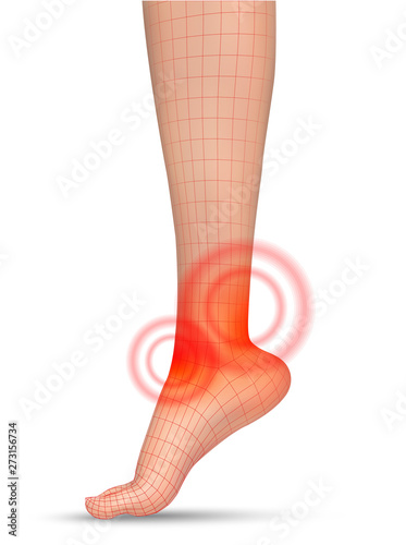 vector human foot.red spots of pain. ready element for medicine and orthopedics