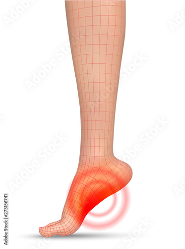 vector human foot.red spots of pain. ready element for medicine and orthopedics