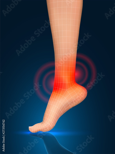 vector human foot.red spots of pain. ready element for medicine and orthopedics
