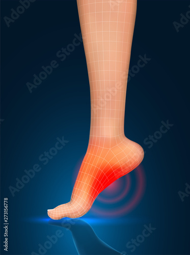 vector human foot.red spots of pain. ready element for medicine and orthopedics