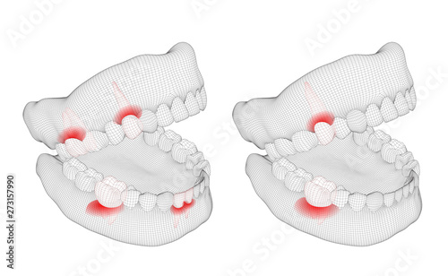 human jaw. 3d vector layout. medicine and health. pain teeth.