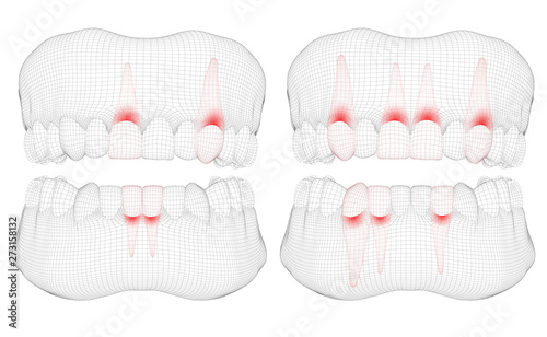human jaw. 3d vector layout. medicine and health. pain teeth.