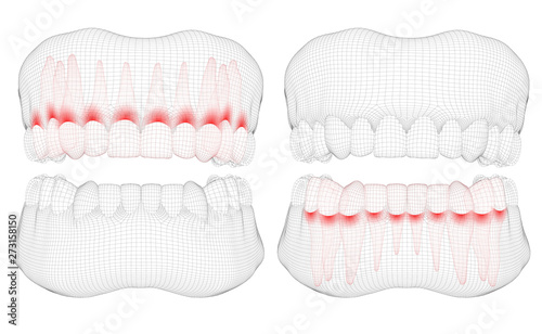 human jaw. 3d vector layout. medicine and health. pain teeth.