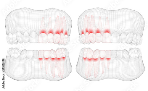 human jaw. 3d vector layout. medicine and health. pain teeth.