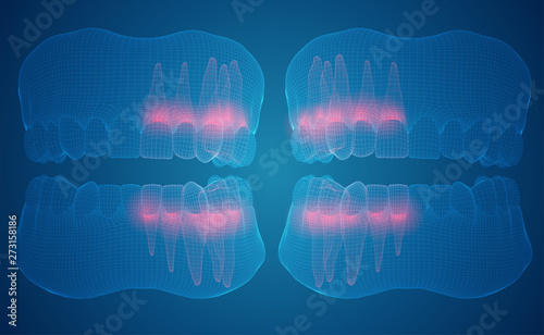 human jaw. 3d vector layout. medicine and health. pain teeth.