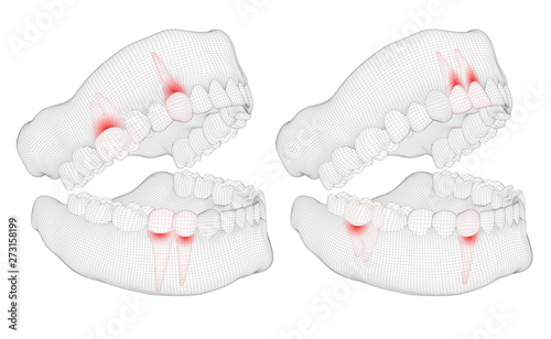 human jaw. 3d vector layout. medicine and health. pain teeth.