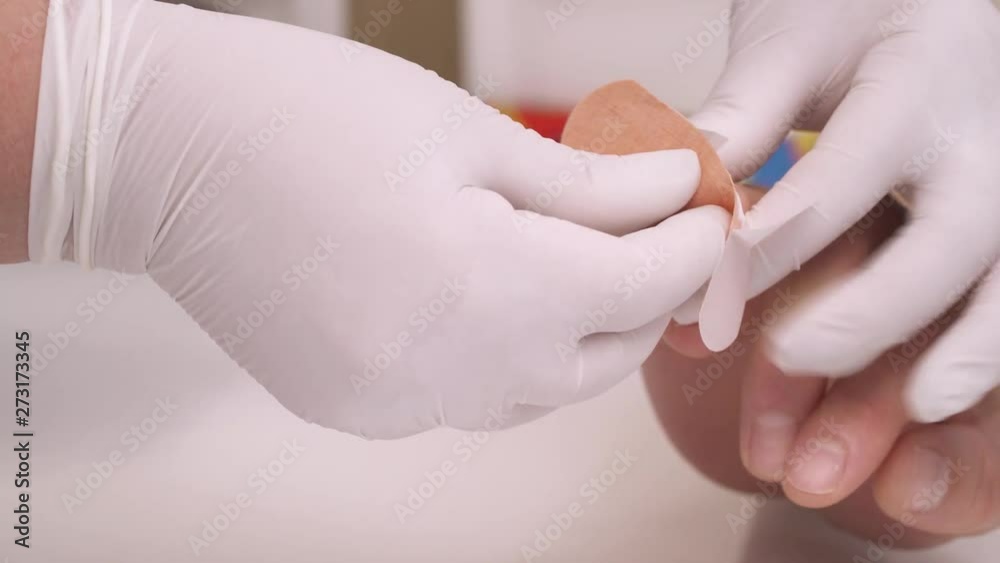 A close-up demonstration of a laboratory technician in gloves putting medical plaster on patients finger after taking a sample of blood. Healthcare concept. A close-up demonstration of a laboratory technician in gloves putting medical plaster on patients finger after taking a sample of blood. Healthcare concept.