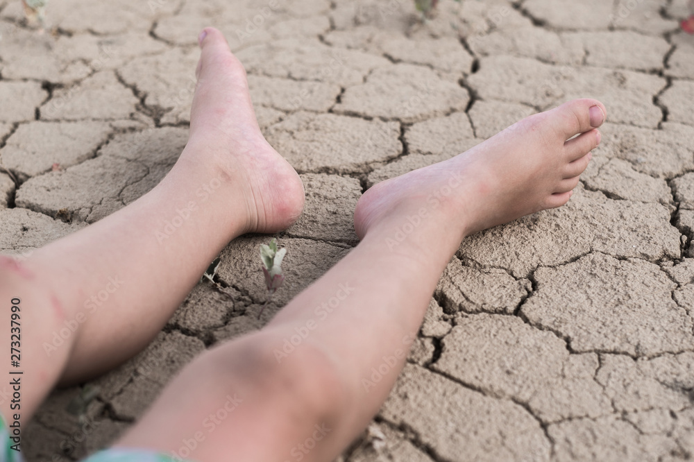 Fainting from heat, dehydration in a child. Children's feet lie on