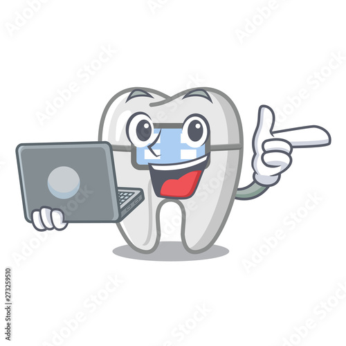 With laptop braces in the character gear box