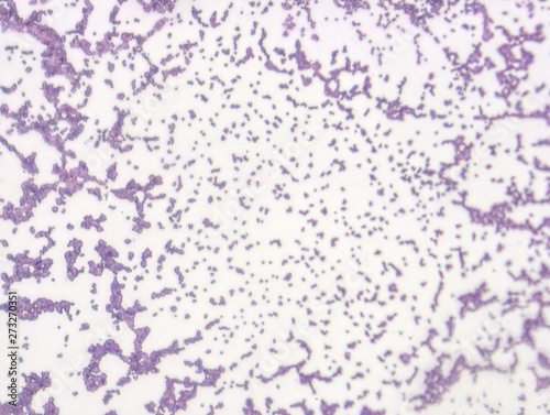Microbiological microscope photograph