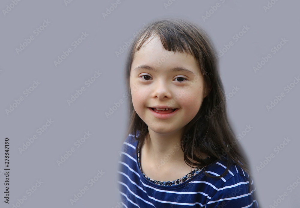 Cute down syndrome girl on the grey background Cute down syndrome girl on the grey background