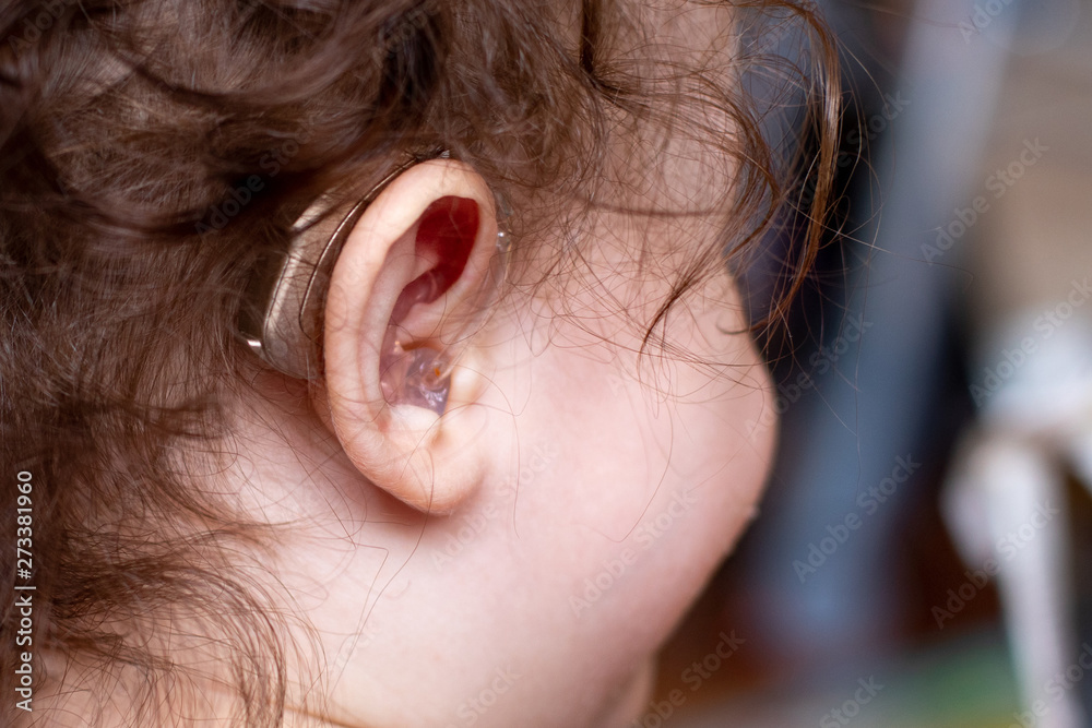 hearing aid on the ears of a child