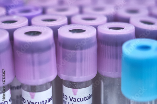 macro of test tubes with purple top, against a gradient of white background. Laboratory