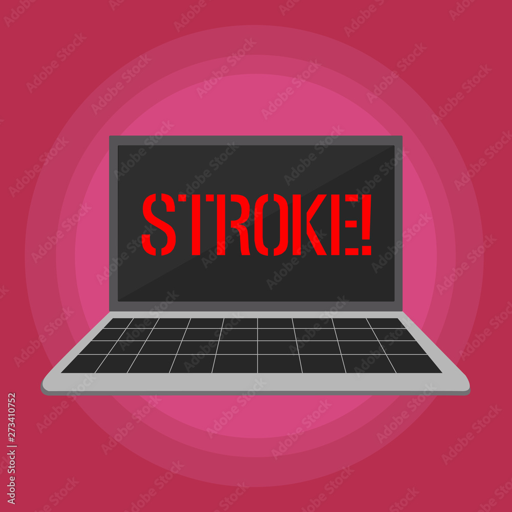 Text sign showing Stroke. Business photo text Patients losing consciousness due to poor blood flow medical Laptop with Grid Design Keyboard and Blank Black Screen on Pastel Backdrop Text sign showing Stroke. Business photo text Patients losing consciousness due to poor blood flow medical Laptop with Grid Design Keyboard and Blank Black Screen on Pastel Backdrop