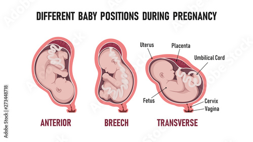 Different baby positions during pregnancy photo
