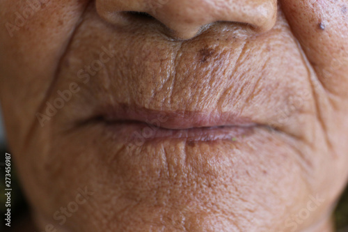 Human mouth  old people  wrinkled skin
