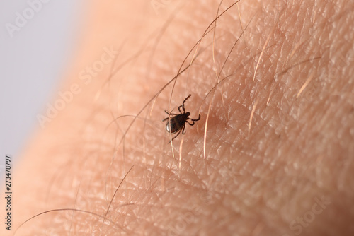 tick climbs on the skin © Homestudio