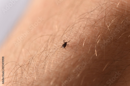 tick climbs on the skin