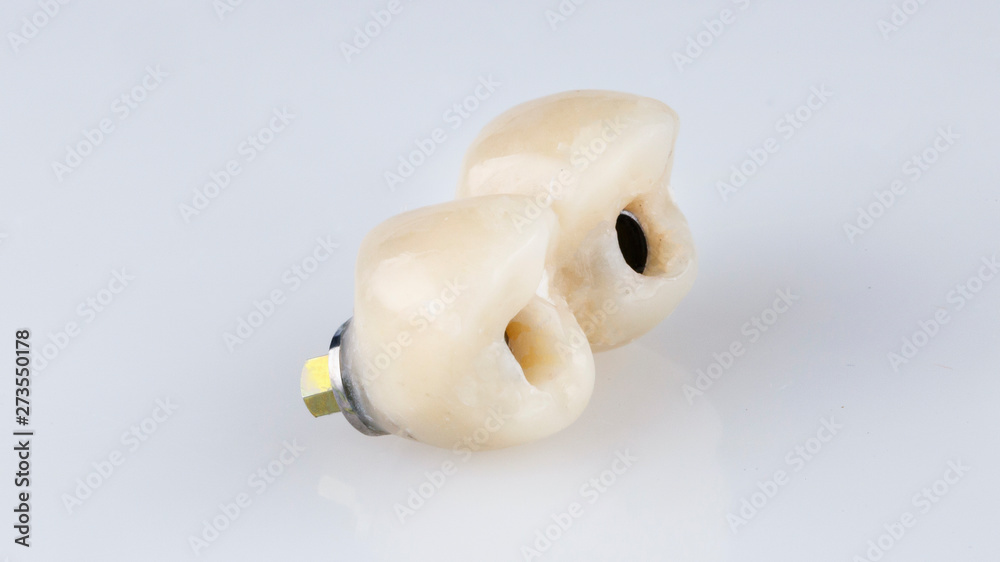two dental crowns made of polymer on a white background two dental crowns made of polymer on a white background