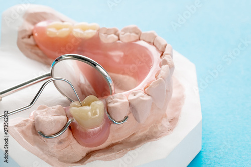 Close up, Artificial removable partial denture or temporary partial denture on blue ground.