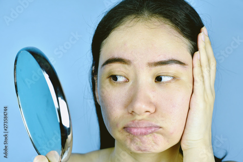 Foto Asian woman looking at her facial problem in the mirror, Female feeling annoy about her reflection appearance show the aging skin signs, wrinkles, dark spot, pimple, acne scar, large pores, dull skin