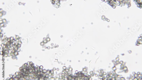 Trypanosoma cruzi microscope view; human diseases photo