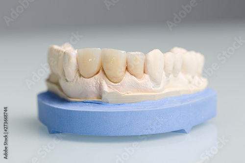 close up of denture parts in dental laoratory