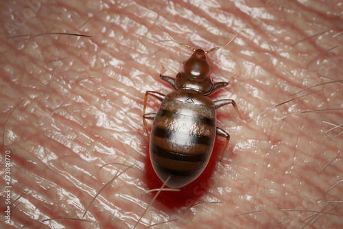 3d rendered medically accurate illustration of a bed bug on human skin