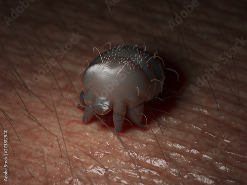 3d rendered medically accurate illustration of a scabies mite on human skin photo