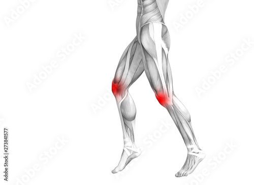 Conceptual knee human anatomy with red hot spot inflammation or articular joint pain for leg health care therapy or sport muscle concepts. 3D illustration man arthritis or bone osteoporosis disease © high_resolution