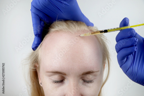 Hair mesotherapy or hair transplant: a beautician doctor makes injections in the head of a woman for hair growth or to prevent baldness