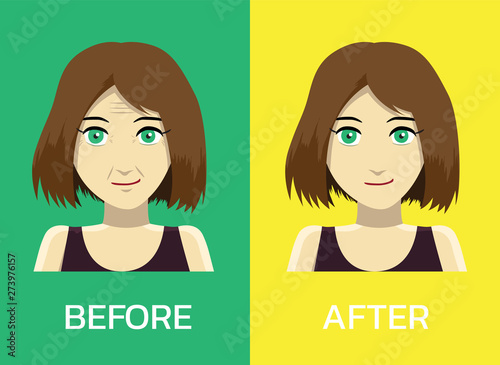Botox Before After Face Manga Woman Cartoon Vector Illustration-01