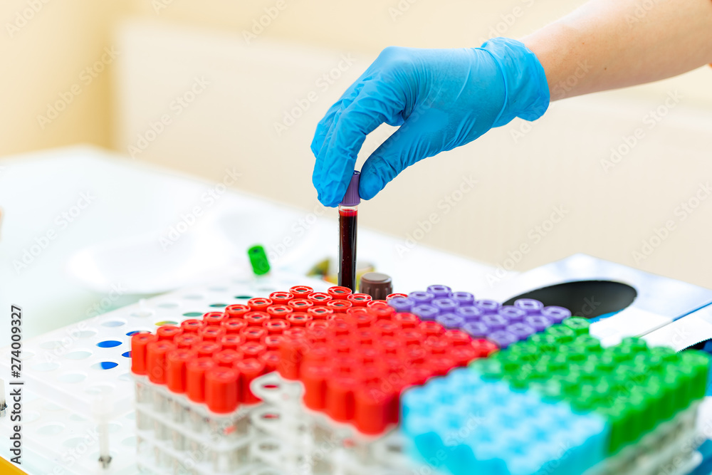 Female nurse puts blood samples in tubes onto a special rack on a table. Doctor's hands in blue latex gloves put the test tube in a rack with many colorful vials in a laboratory. Close-up.