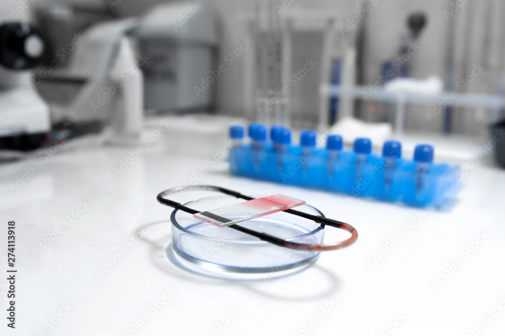 scientist prepare blood sample for research on microscope. Placing blood sample on microscope slide